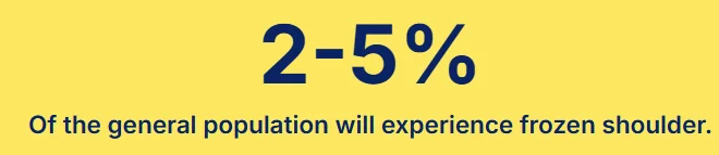 Diagram showing what frozen shoulder (adhesive capsulitis) is and how it affects the joint capsule